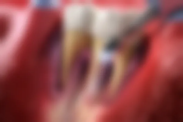 补牙时使用的氧化锌是什么材料？它在牙科治疗中的作用和优势是什么？