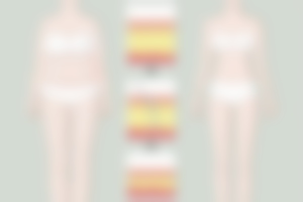 郑州丽天整形医院吸脂项目怎么样？罗明生医生技术专精+价格合理，附修复周期参考