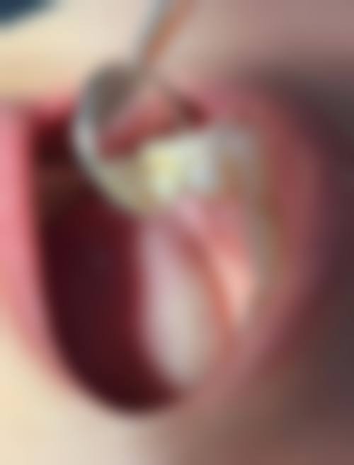 郑州天后医疗美容医院口腔科:合理收费标准