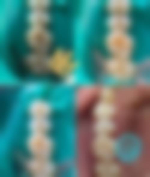 郑州天后医疗美容医院口腔科:多样诊疗项目