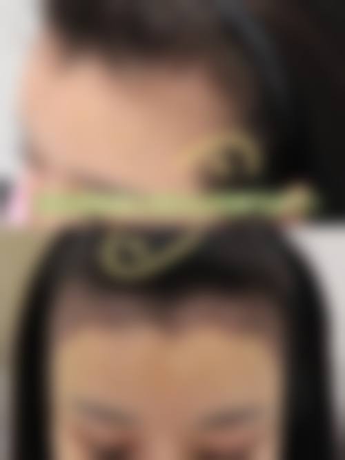 昆明精东植发医院：贴心服务暖人心