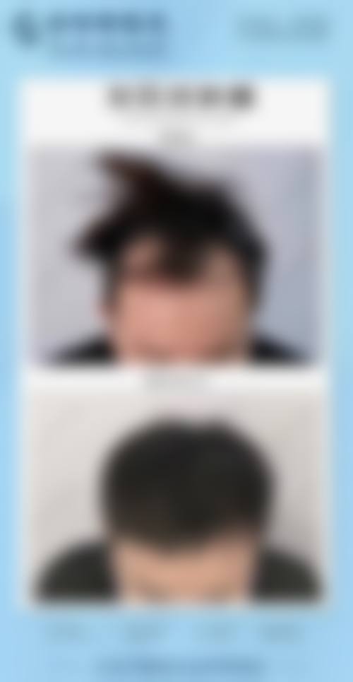 昆明精东植发医院是不是正规医院？是正规的，有资质技术好还能保障植发效果！ 