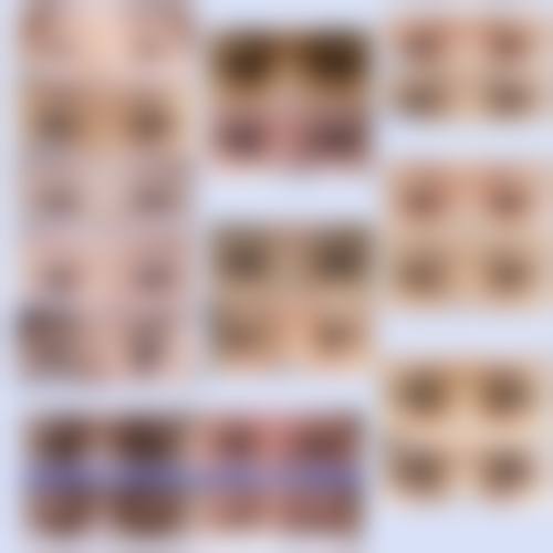 杭州美莱医疗美容医院面部脂肪填充优势与价格