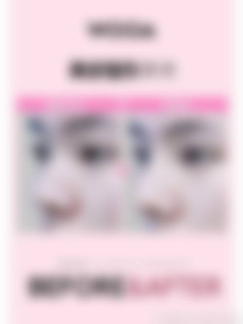 杭州美莱医疗美容医院射频溶脂优惠活动