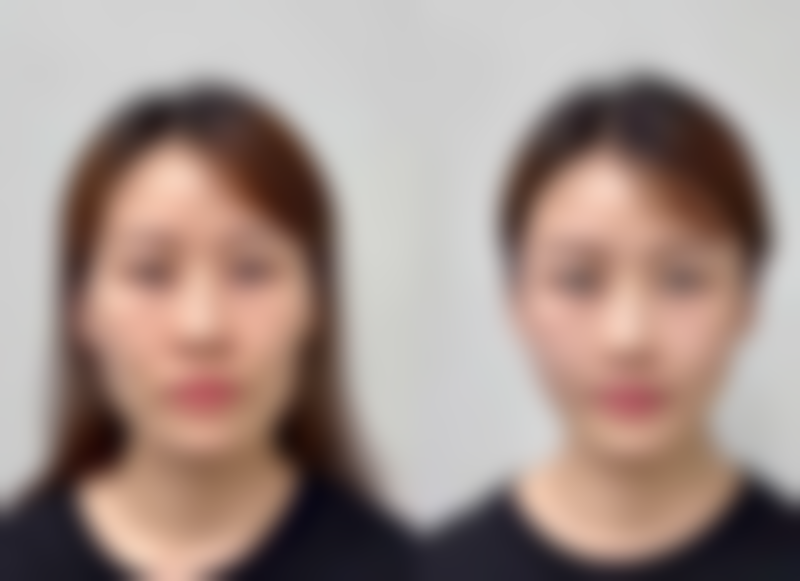 曹孟君吸富贵包的效果：从“驼峰”到“天鹅颈”的华丽转变