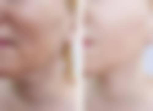 张汉良医生简介怎么挂号