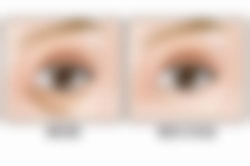 王荀医生简介做手术价格分析