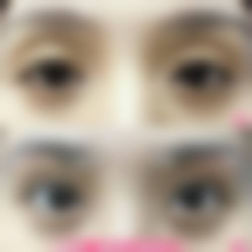 射洪秘龄整形医院怎么样之真实患者口碑评价