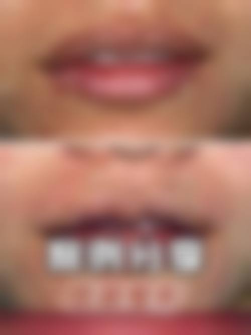 浦江朱美姣医疗美容诊所怎么样，价格表