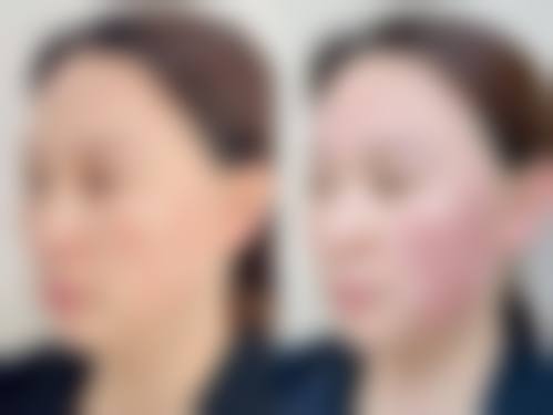 曾祥康医生顾客实例图片