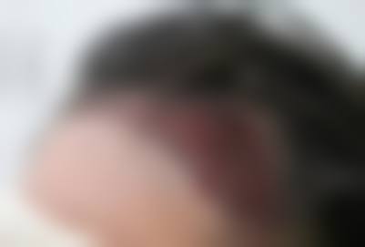 杭州清沐整形美容怎么样之是否正规