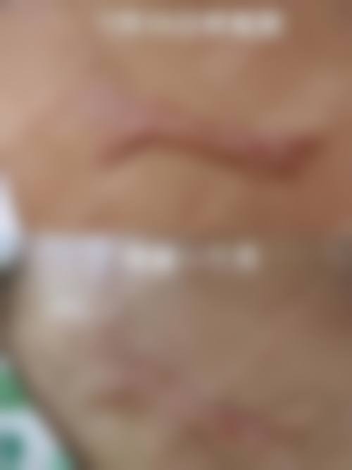 张震医生简介口碑如何