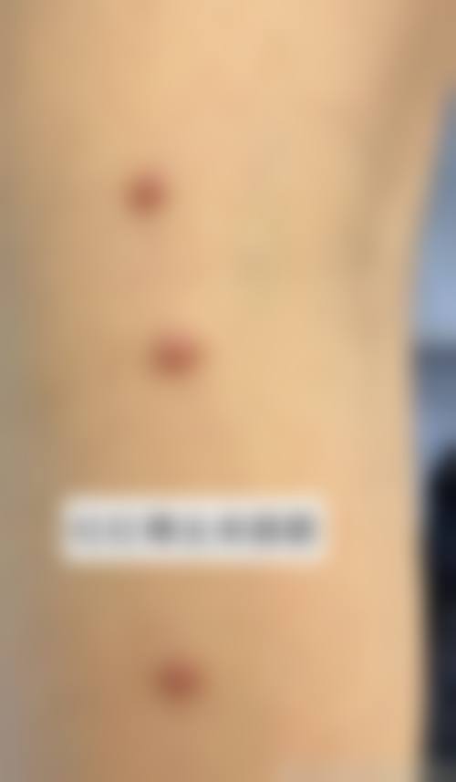 藤本皮肤科口碑好不好