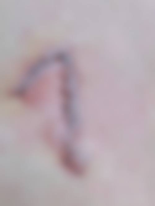 大石桥星悦柠檬整形医院地址及乘车路线