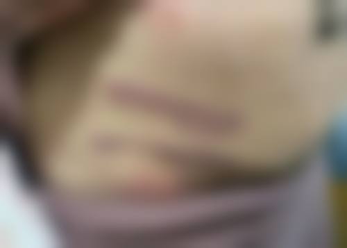 重庆拜博整形美容医院口碑好不好