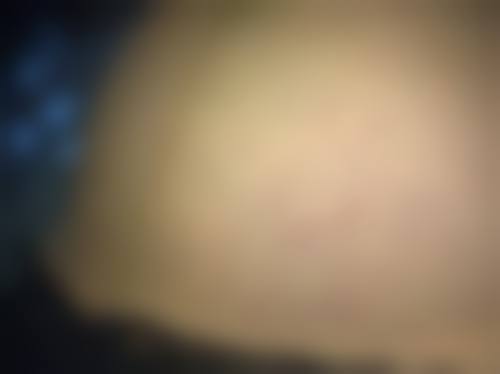 WOOA整形医院项目特色