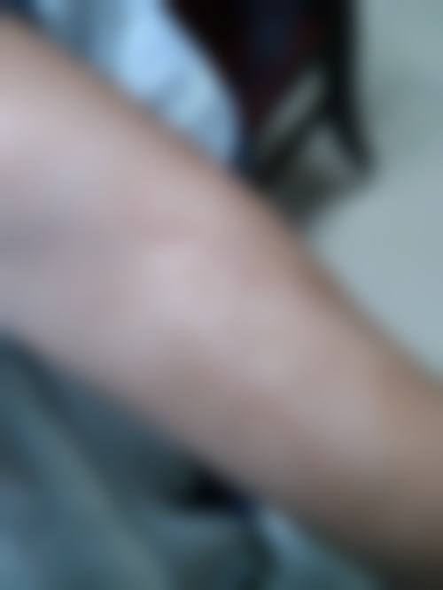 藤本皮肤科正规吗？有何特色项目