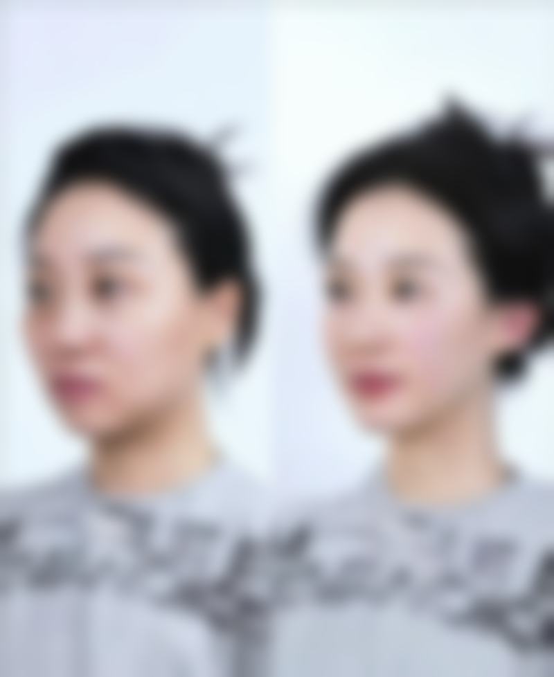 侯娜医生简介项目优势