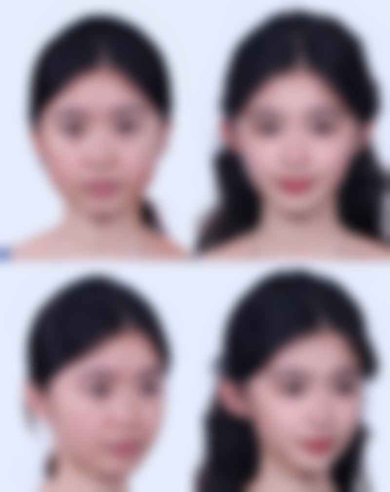 申会琴医生项目优势