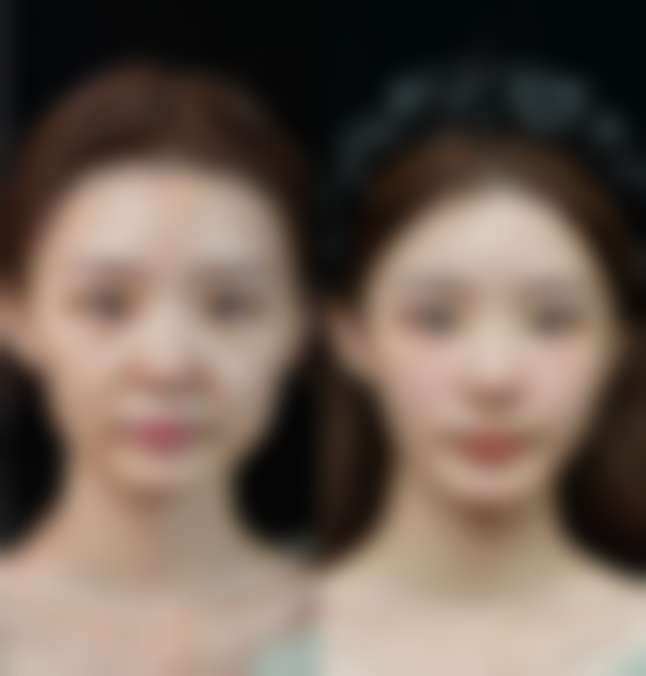 广州医选医疗美容抖音团购活动及价格表