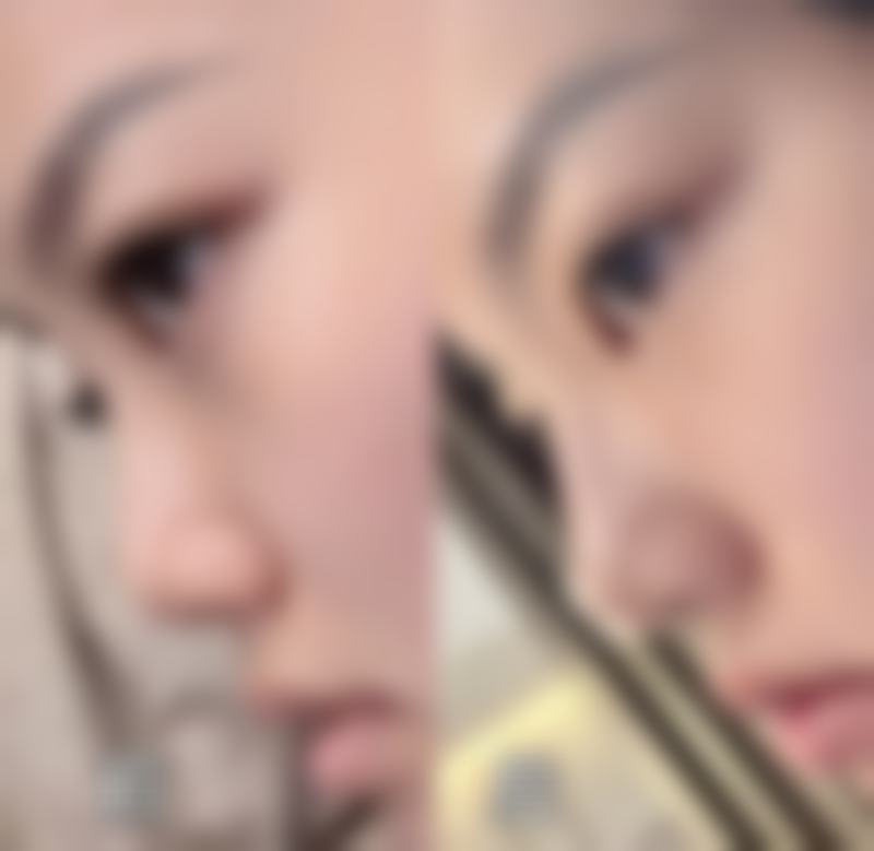 齐齐哈尔千百度医疗美容诊所评价