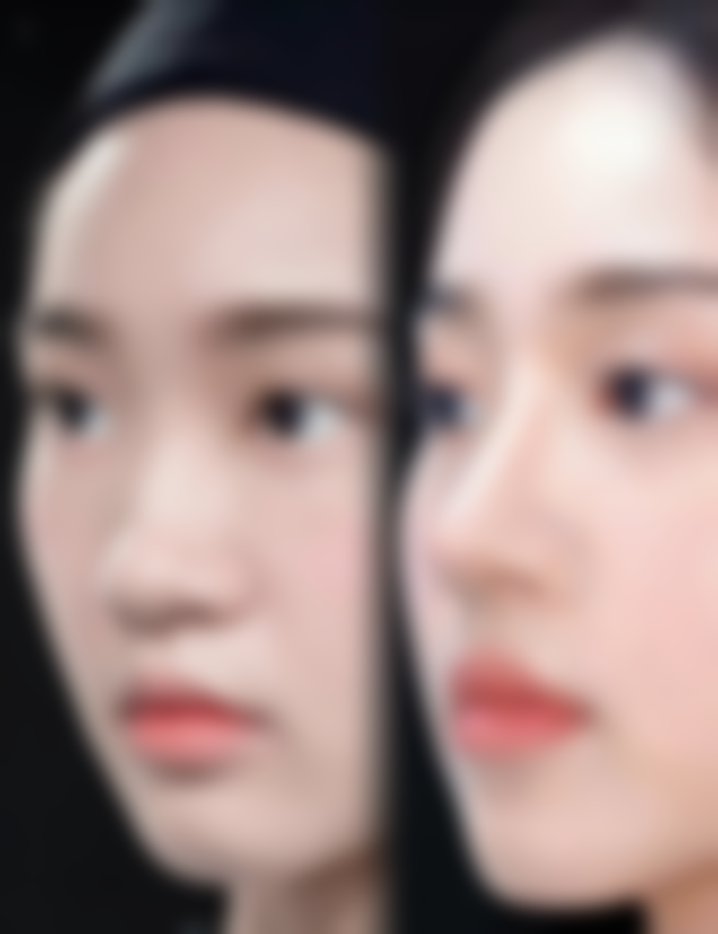 杭州清沐整形美容怎么样之抖音团购活动与价格表