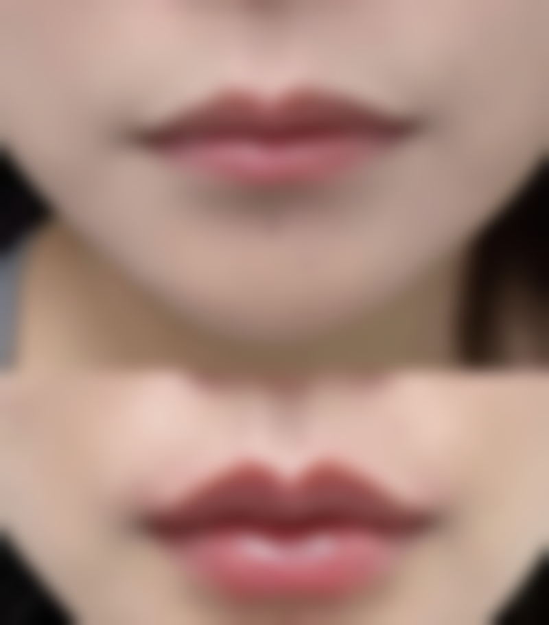 张汉良医生简介做手术价格