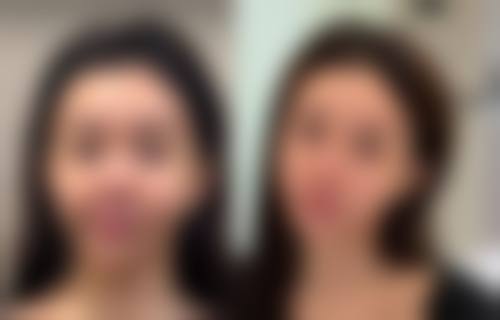 上海千美整形医院怎么样，口碑评价如何？