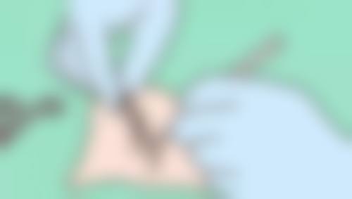 哈尔滨悠然国内外医疗整形医院价格表