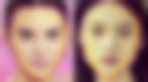 山西伊特雅整形美容门诊抖音团购活动有哪些，价格表