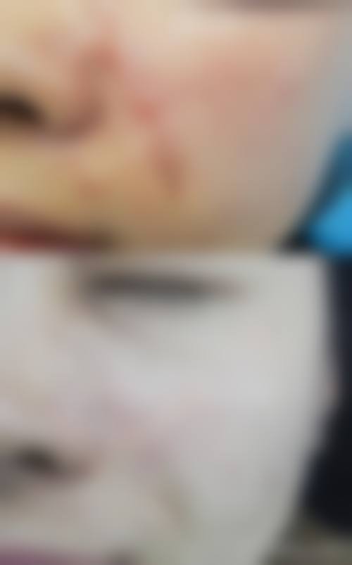 veritec美容外科诊所价格表