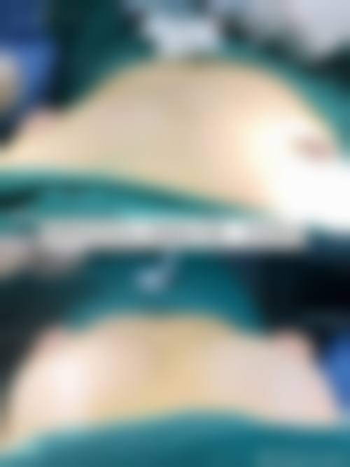 韩国首尔芭啦本整形外科医生情况