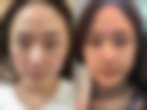 七、青海康华整形美容医院口碑好不好？附真实患者口碑评价