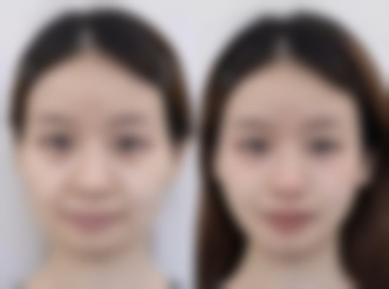 上海千美整形医院价格表