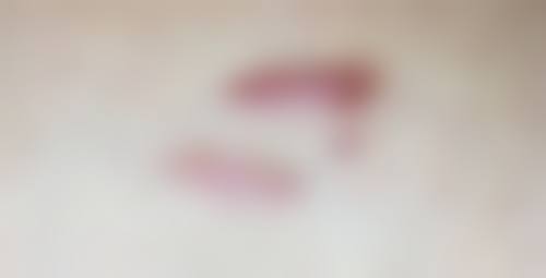 烟台莱山京韩医疗美容诊所怎么样，可靠吗