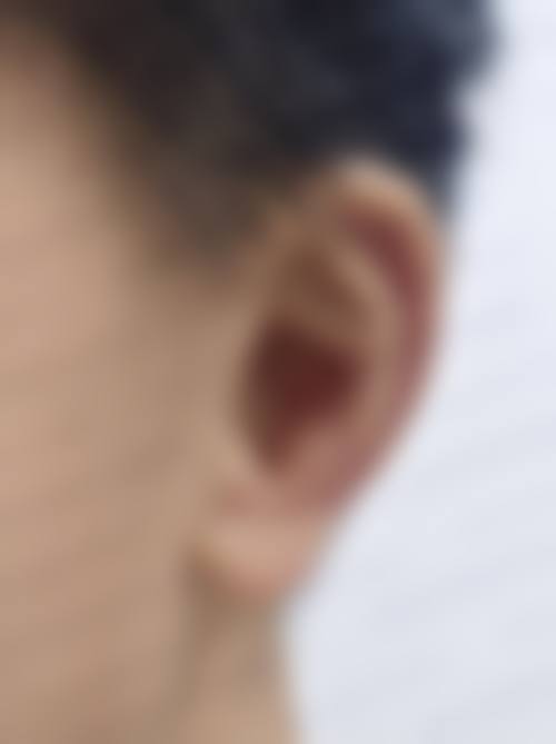 西安新城京肤医疗美容门诊部怎么样：顾客实例