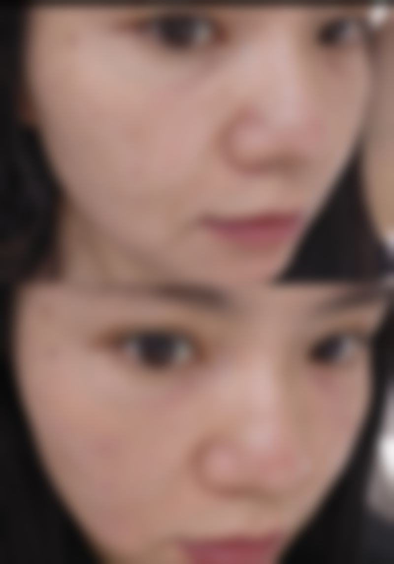 烟台莱山京韩医疗美容诊所怎么样，更擅长什么手术