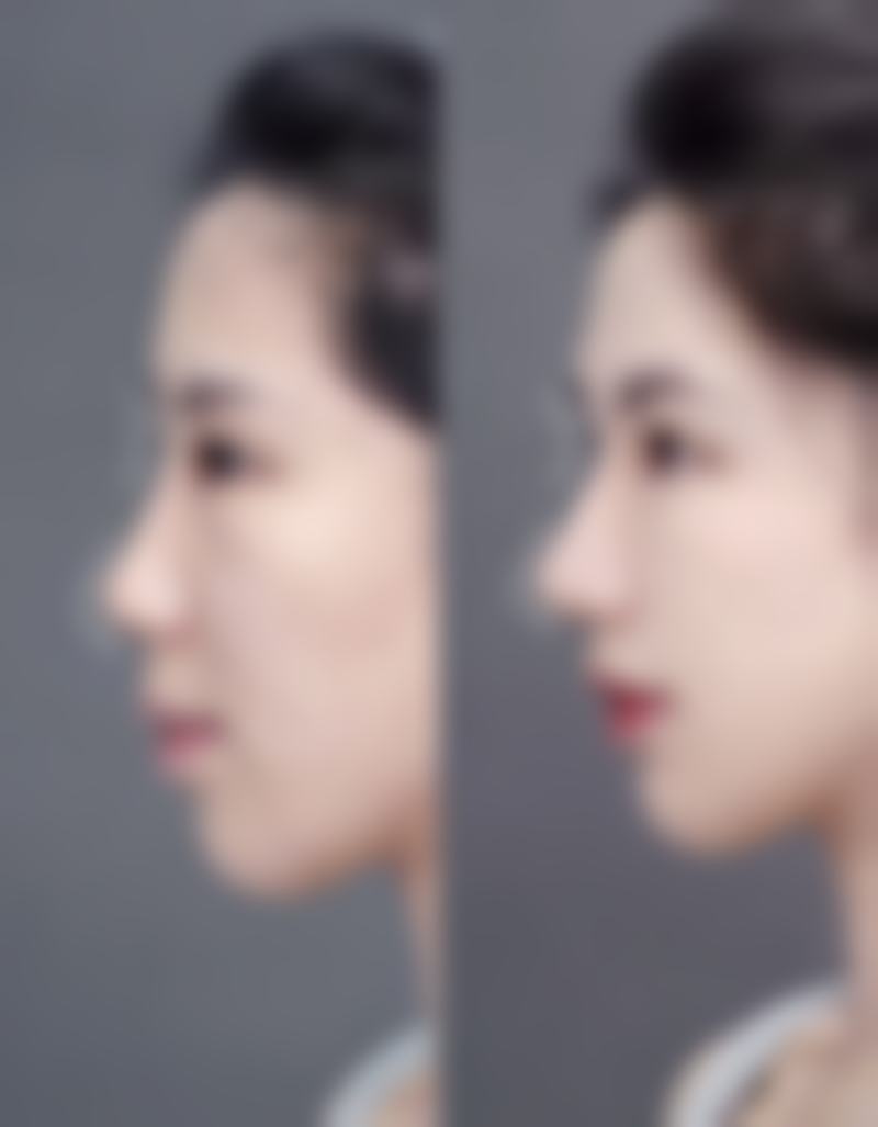 西安雁塔医疗美容诊所怎么样，评价