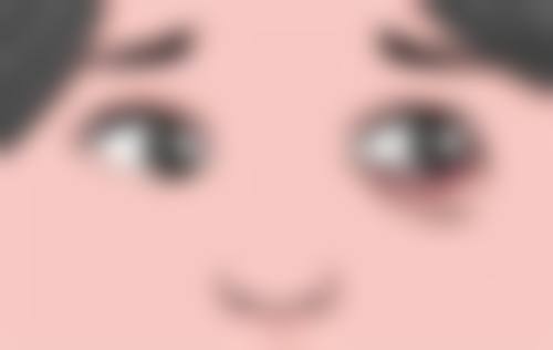 双眼皮割窄加宽修复手术的价格大揭秘