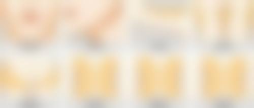 做眼袋手术大概需要多久恢复？内切1周外切3个月，激光抽脂恢复更快