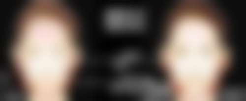 疤痕疙瘩能长平吗？激光治疗+手术切除双管齐下，青少年也能恢复平滑肌肤