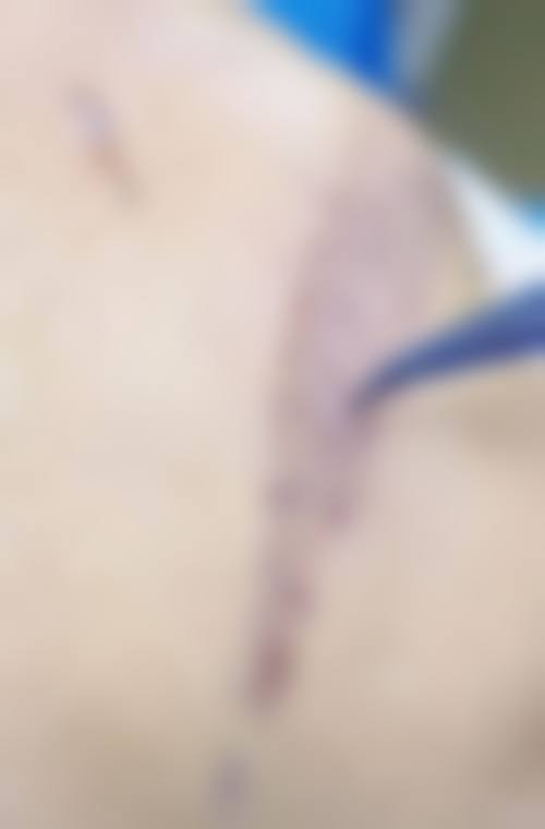 深圳美客华美医疗美容门诊部地址在哪里