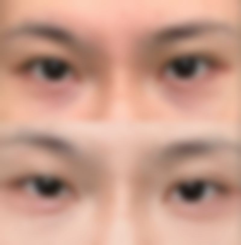 去去眼袋用什么方法至佳：食疗调理，从内而外的“美丽工程”