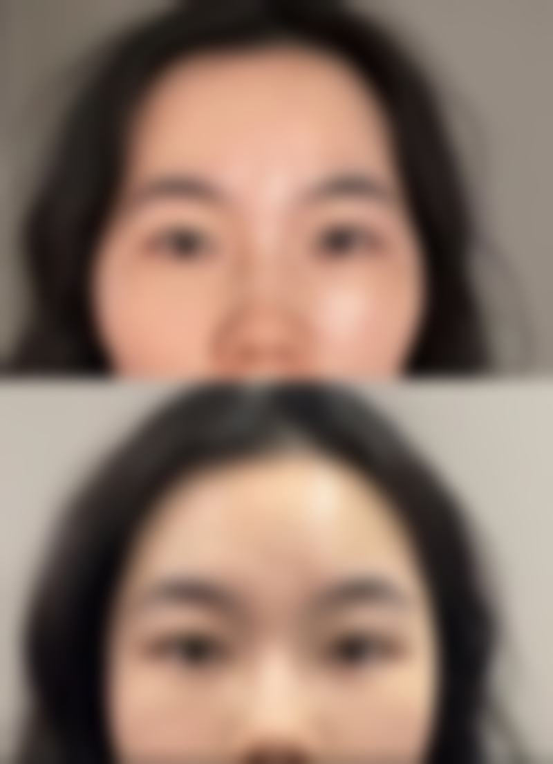 用牙签划出双眼皮需坚持多久：每天5分钟坚持3周的科学依据