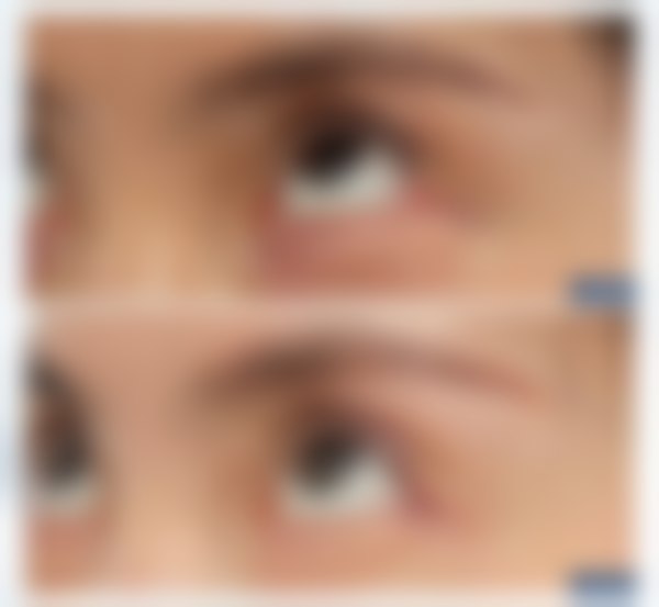 上海爱尚丽格医疗美容门诊部杜园园医生：眼修复界的“金手指”