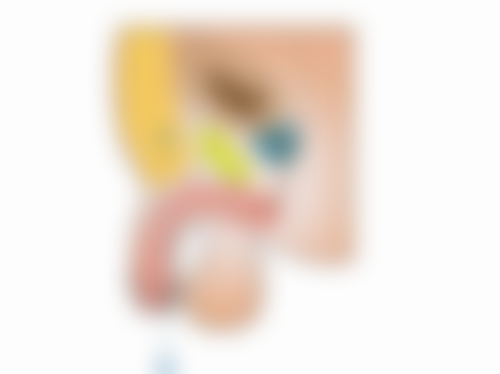 双眼皮拆线后眼角小疙瘩的注意事项谨记