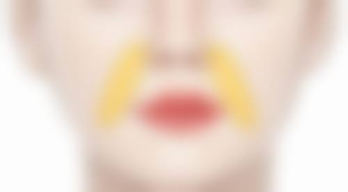 伤口缝针后如何不留疤痕：精细把握拆线时机与护理