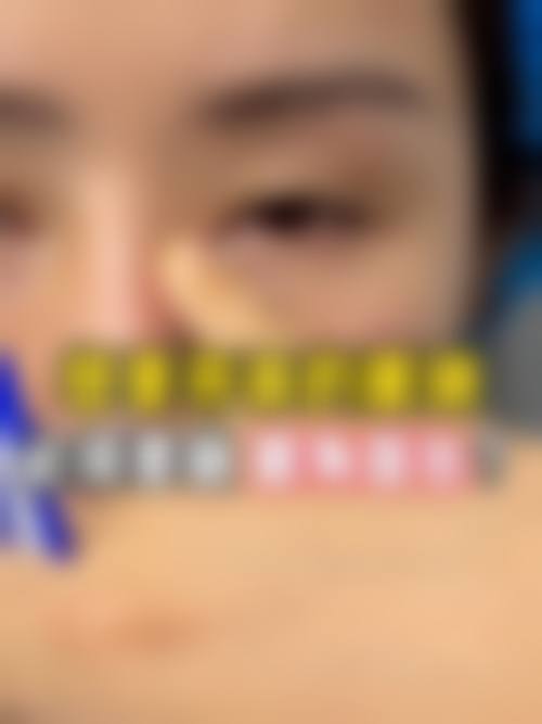 深圳港美医疗美容医院价格表