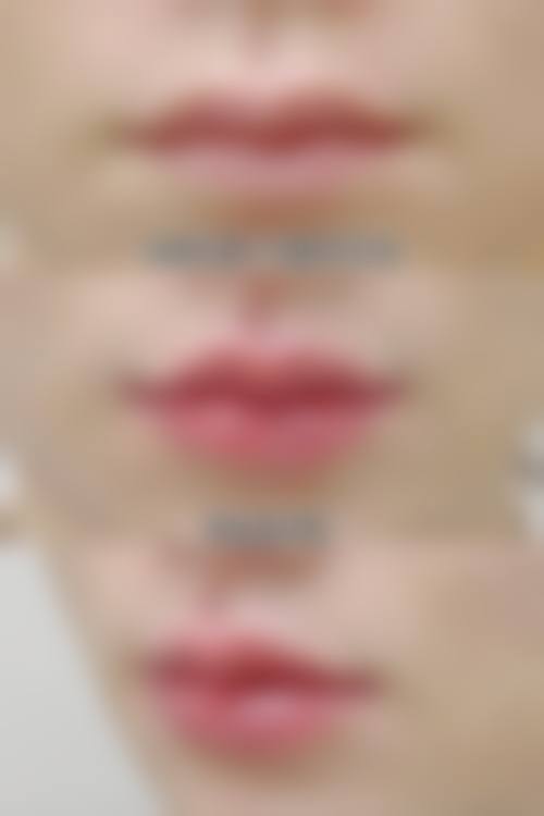 深圳吴小兵医疗美容诊所怎么样，更擅长什么手术