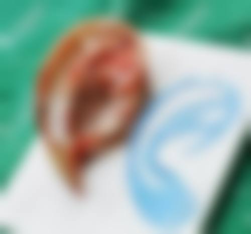 青海人民医院颌面整形外科价格表